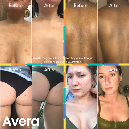 Avera Mandelic Radiance Serum